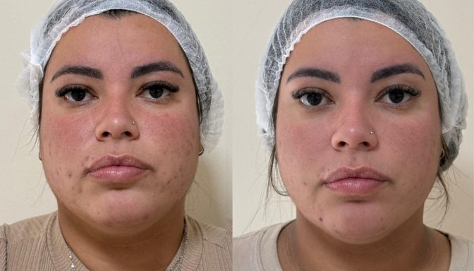 Depoimento Jenniffer Gonçalves